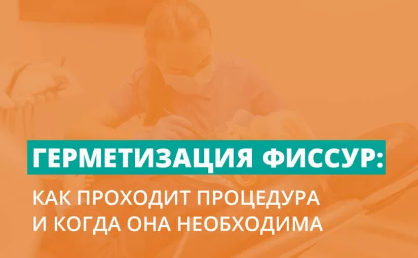 Герметизация фиссур: как проходит процедура и когда она необходима